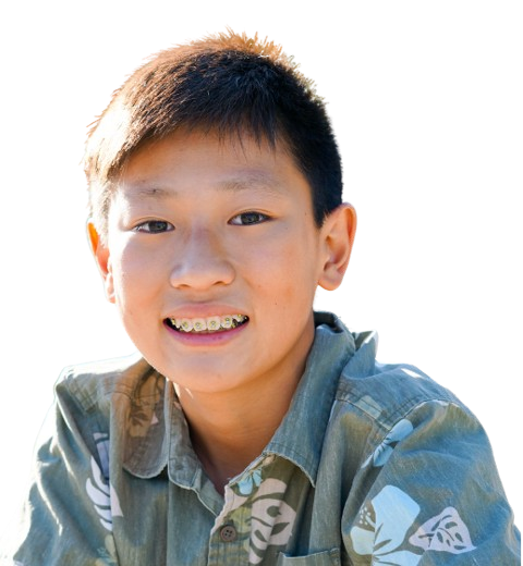 Custom_Braces-Service_Image